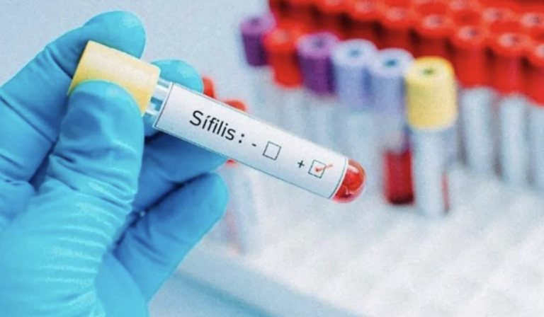 Sífilis: alerta por récord nacional 